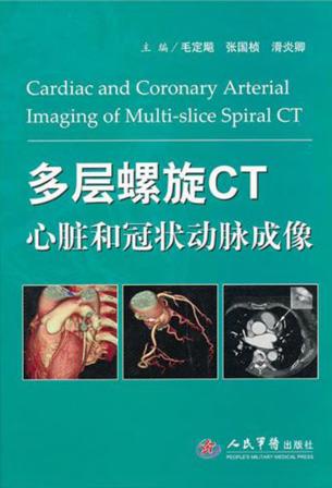 多层螺旋CT心脏和冠状动脉成像 封面
