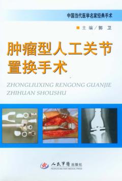 肿瘤型人工关节置换手术 封面