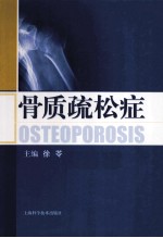 骨质疏松症 封面
