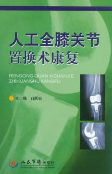 人工膝关节置换术康复 封面
