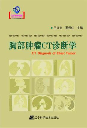 胸部肿瘤CT诊断学 封面