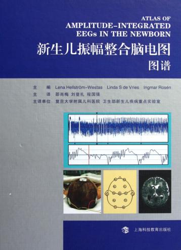 新生儿振幅整合脑电图图谱 封面