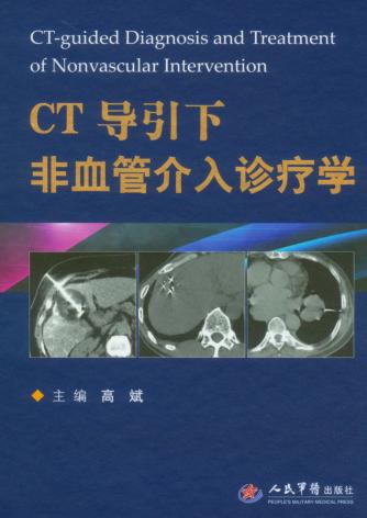 CT导引下非血管介入诊疗学 封面