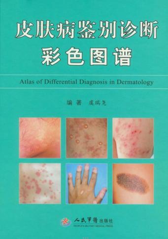 皮肤病鉴别诊断彩色图谱 封面