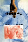 针灸补泻手法 封面
