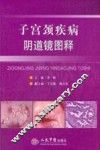 子宫颈疾病阴道镜图释 封面