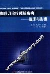 伽玛刀治疗颅脑疾病  临床与影像 封面
