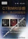 CT和MRI诊断重点热点问题精讲u3000u3000修订版 封面