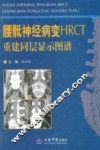 腰骶神经病变HRCT  重建同层显示图谱 封面