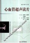 心血管超声读片 封面