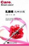 乳腺癌  这样征服 封面