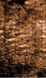 伤寒恒论  卷5-8 封面