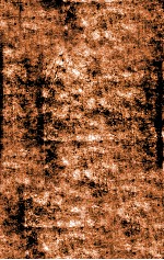 痘疹正宗  卷下 封面