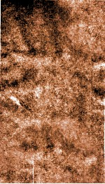 痘疹集成  卷2 封面