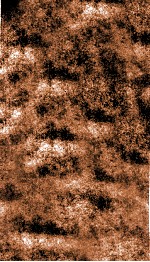 痘疹集成  卷3 封面