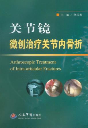 关节镜微创治疗关节内骨折 封面