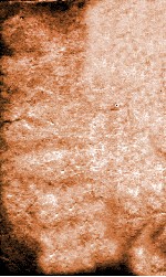 冯氏锦囊秘录痘疹全集  卷3-6 封面