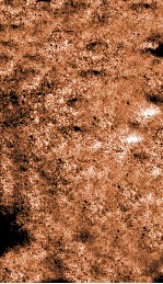 痘疹传新录  卷16-17 封面