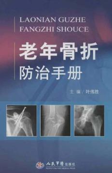 老年骨折防治手册 电子书封面