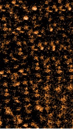 引痘略  上 封面