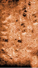 痘疹正宗金鉴  卷1 封面