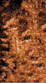 痘疹正宗金鉴  卷3 封面