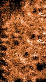 痘疹正宗金鉴  卷4 封面