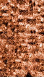 痘疹正宗  上 封面