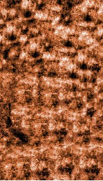 痘疹正宗  中 封面