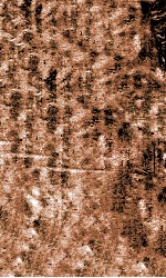 痘疹定论  卷3-4 封面