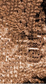 翁仲仁先生痘疹金镜录  卷下 封面