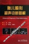 胎儿畸形超声诊断图解 封面