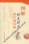 图解针灸针刀治疗颈肩痛 封面
