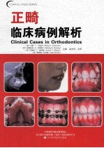 口腔临床病例解析丛书  正畸临床病例解析 封面