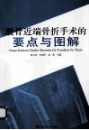 股骨近端骨折手术的要点与图解 封面