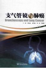 支气管镜与肺癌 封面