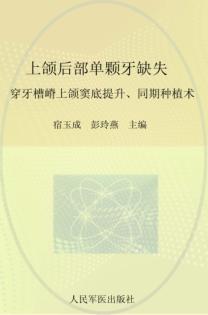上颌后部单颗牙缺失  穿牙槽嵴上颌窦底提升、同期种植术 封面