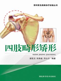 四肢畸形矫形 封面