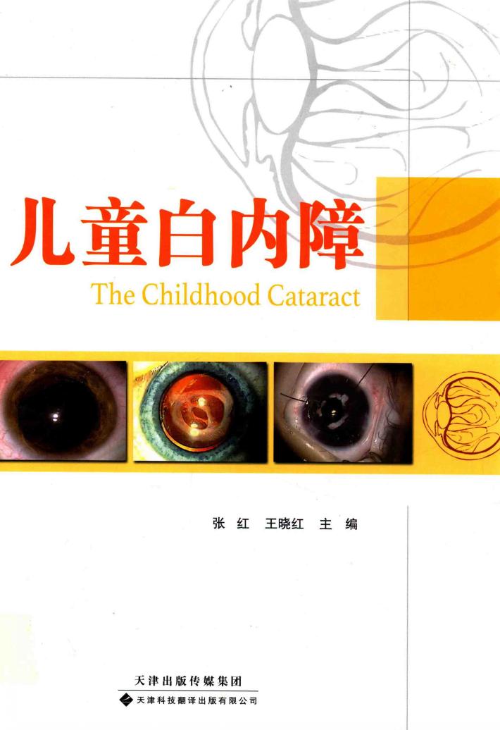 儿童白内障 封面