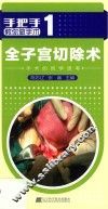 全子宫切除术 封面