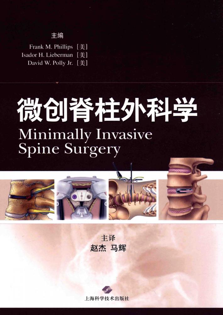 微创脊柱外科学 封面