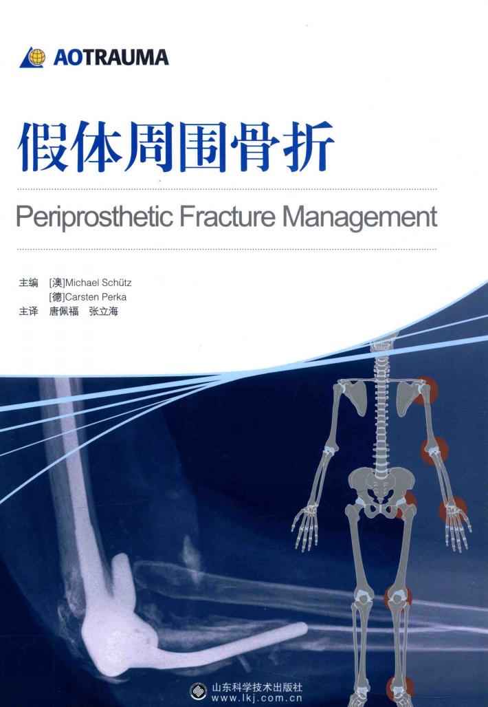 假体周围骨折 封面