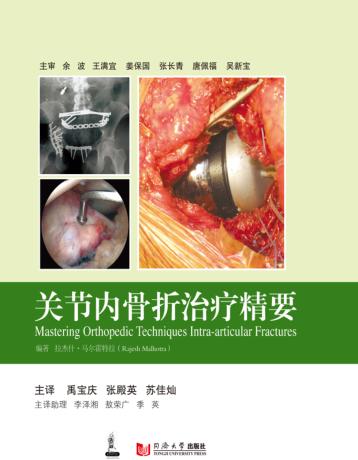 关节内骨折治疗精要 封面