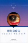 眼红斑痤疮 封面