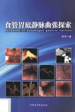 食管胃底静脉曲张探索 封面