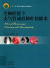 全胸腔镜下支气管成形肺叶切除术 封面