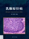 乳腺原位癌 封面