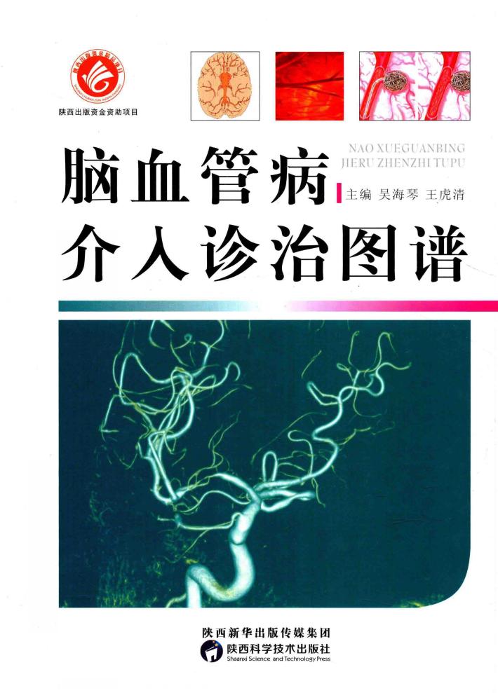 脑血管病介入诊治图谱 封面