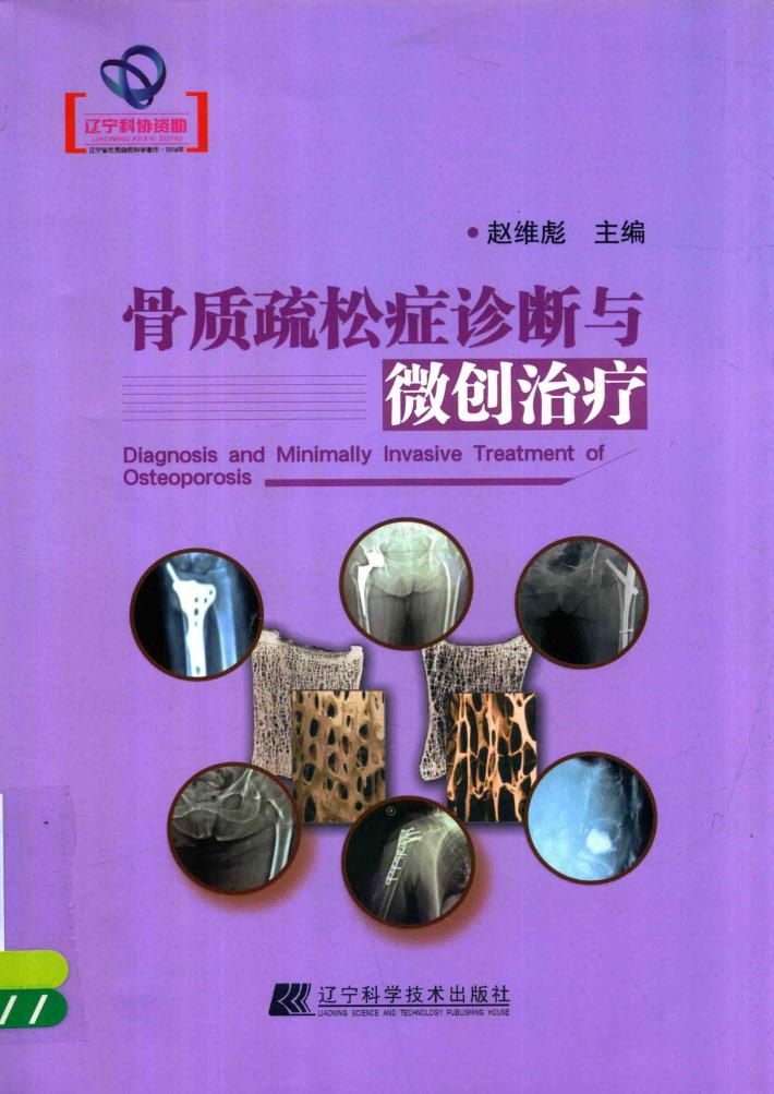 辽宁骨质疏松症诊断与微创治疗 封面