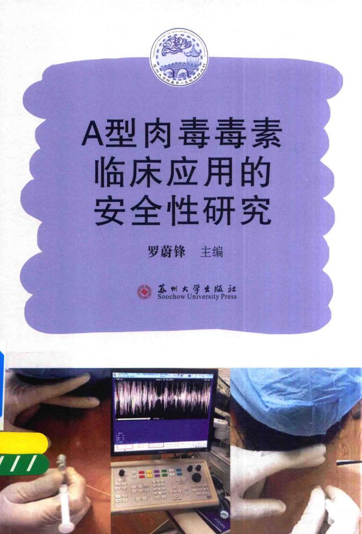 A型肉毒毒素临床应用的安全性研究 封面
